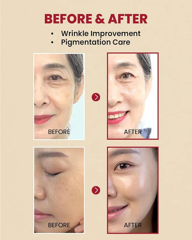 K-SECRET Seoul 1988 Serum — Retinal Liposome 2% + Black Ginseng 30ml